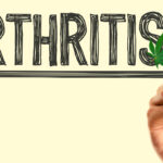Arthritis and Medical Marijuana