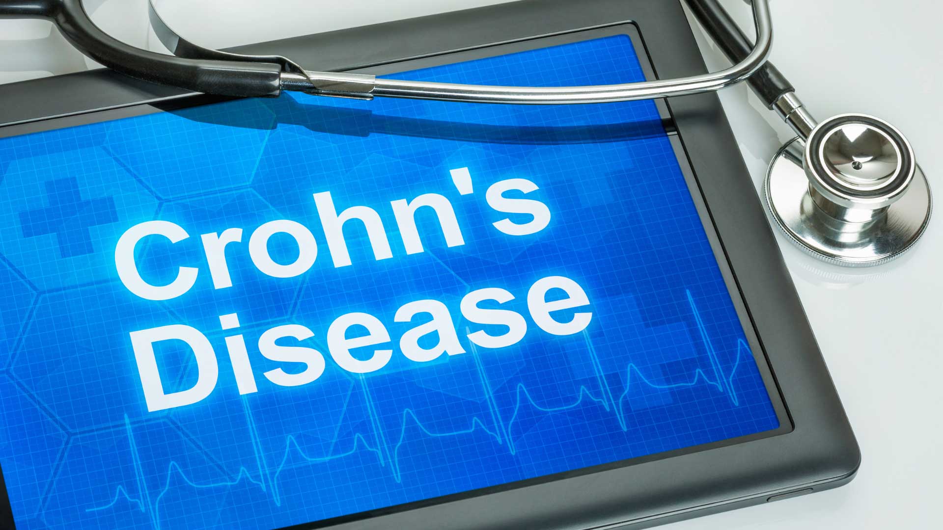 Managing Crohn’s Disease with Medical Marijuana